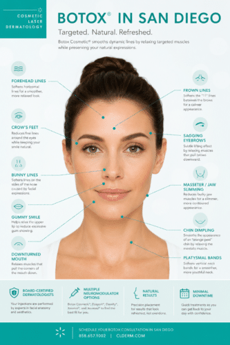 Botox infographic