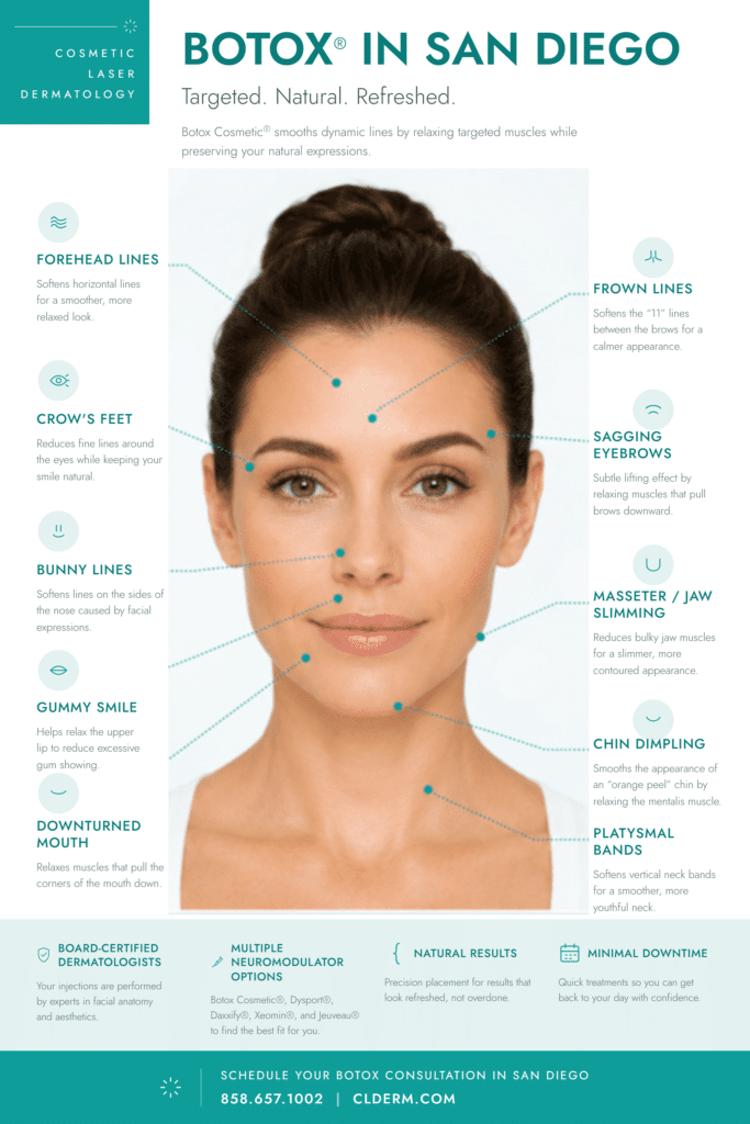 botox in san diego infographic 