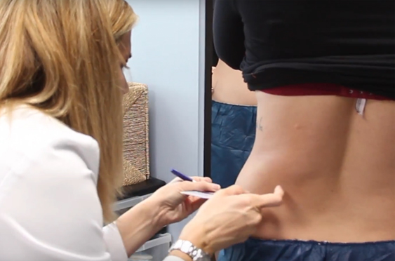 Non-Invasive Body Shaping vs. Traditional Liposuction: Which is Right for  You? - Cosmetic Laser Dermatology Skin Specialists in San Diego