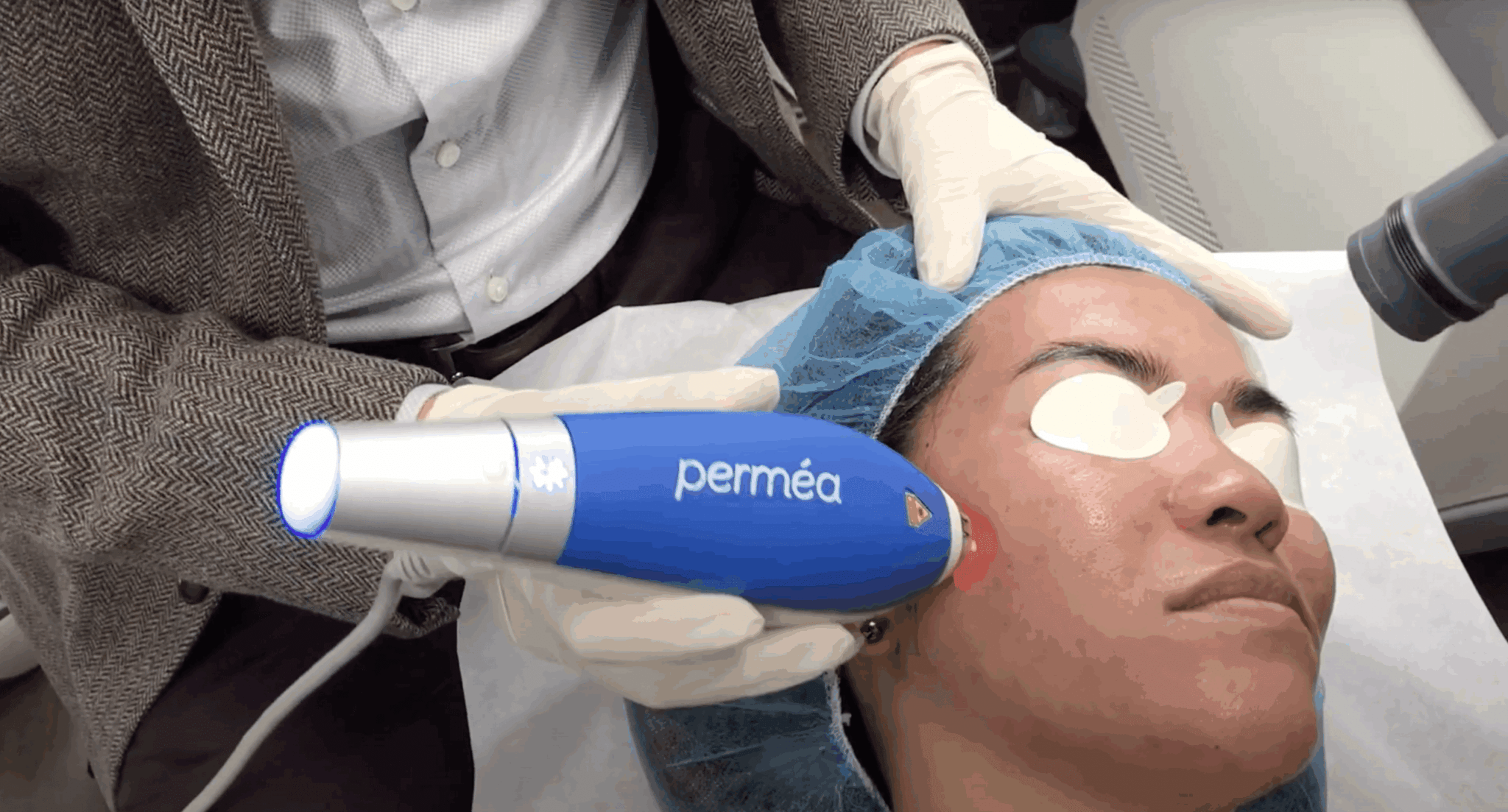 Scar & Acne Scar Treatment Med Spa San Diego, CA CLDerm