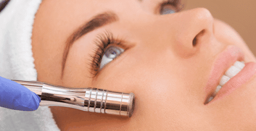 Microdermabrasion La Jolla