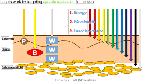 infographic about how Fraxel laser treatments work in San Diego, CA