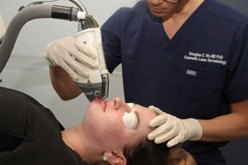 Dr. Wu is performing laser treatment on a woman patient for skin rejuvenation, San Diego, CA.