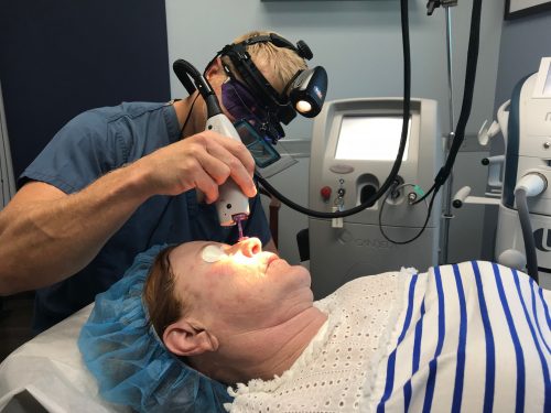 dermatologist treating deep wrinkles on a patient