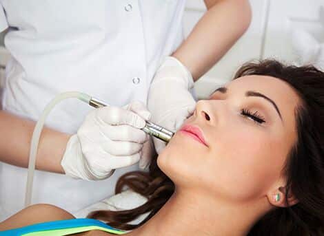 Pigmentation Removal San Diego
