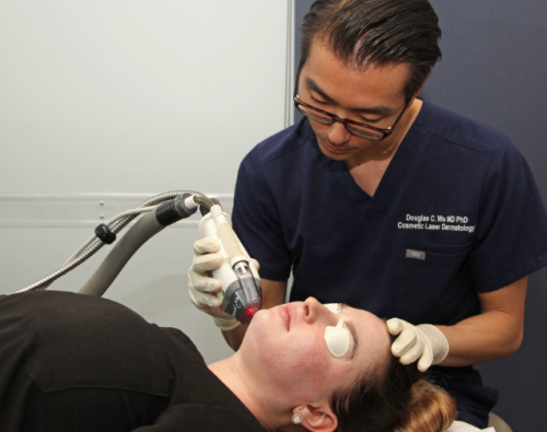 fraxel dual laser skin treatment in san diego, ca