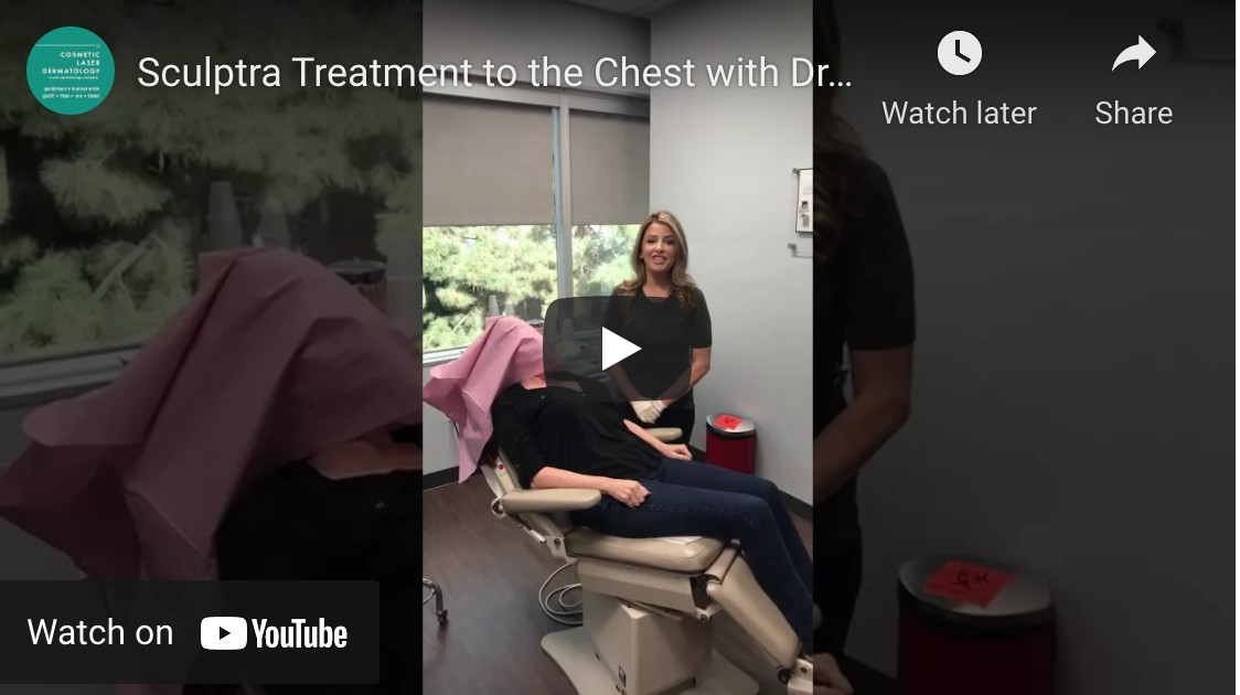 Dr. Fabi performing a Sculptra treatment in order to treat chest wrinkles in San Diego, CA