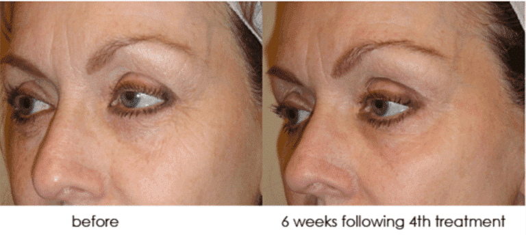dreamscape skin rejuvenation san diego