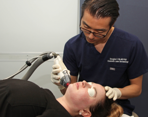 Laser Treatments For Burns San Diego Ca Clderm 