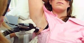 Practitioner performing laser hair removal on female patient's armpit in San Diego