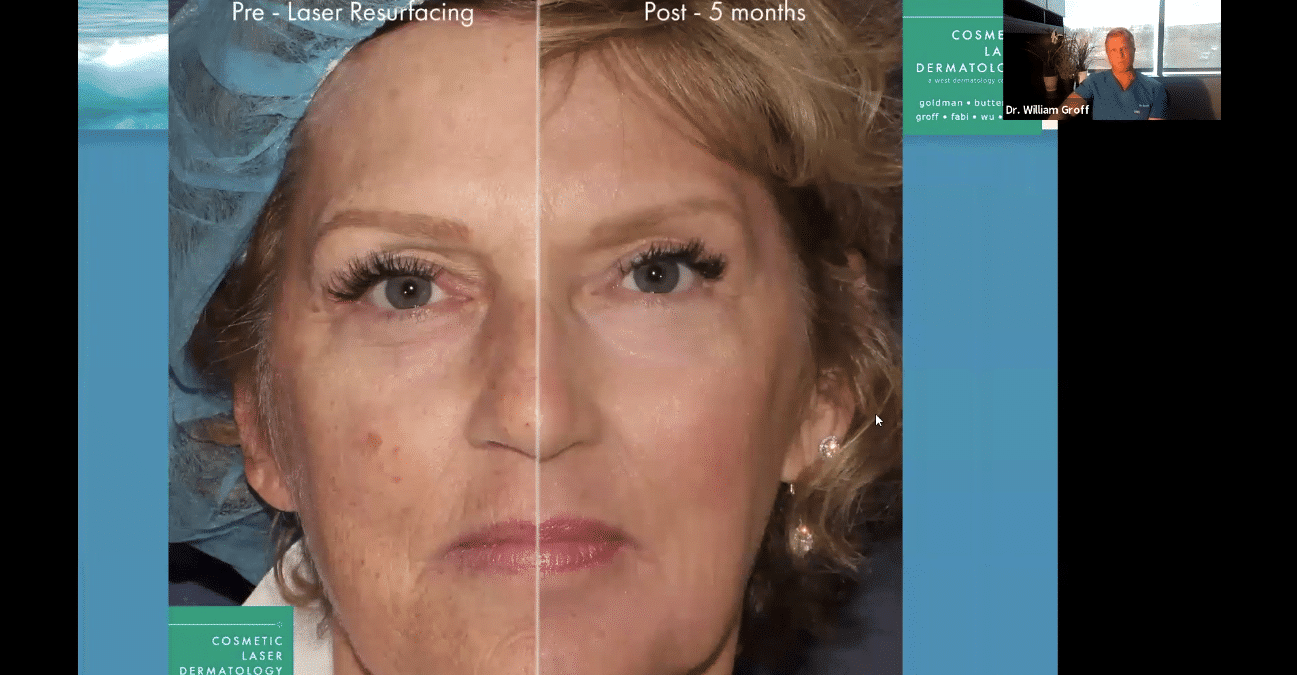 take 10 treatment results in San Diego
