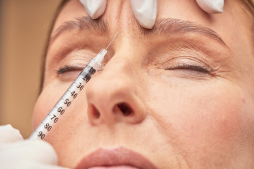 Older women getting anti aging injections to treat her wrinkles, San Diego, CA