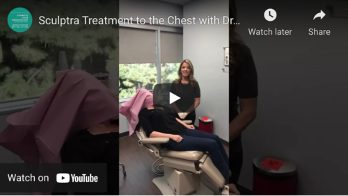 Chest Wrinkle Treatment with Sculptra and Radiesse