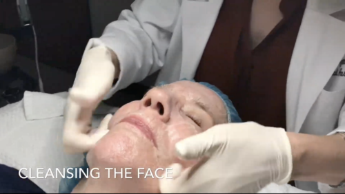 Medical aesthetician Farzaneh Momeni-Salami is applying derma-planing for facial cleansing on her older woman patient in San Diego, CA.