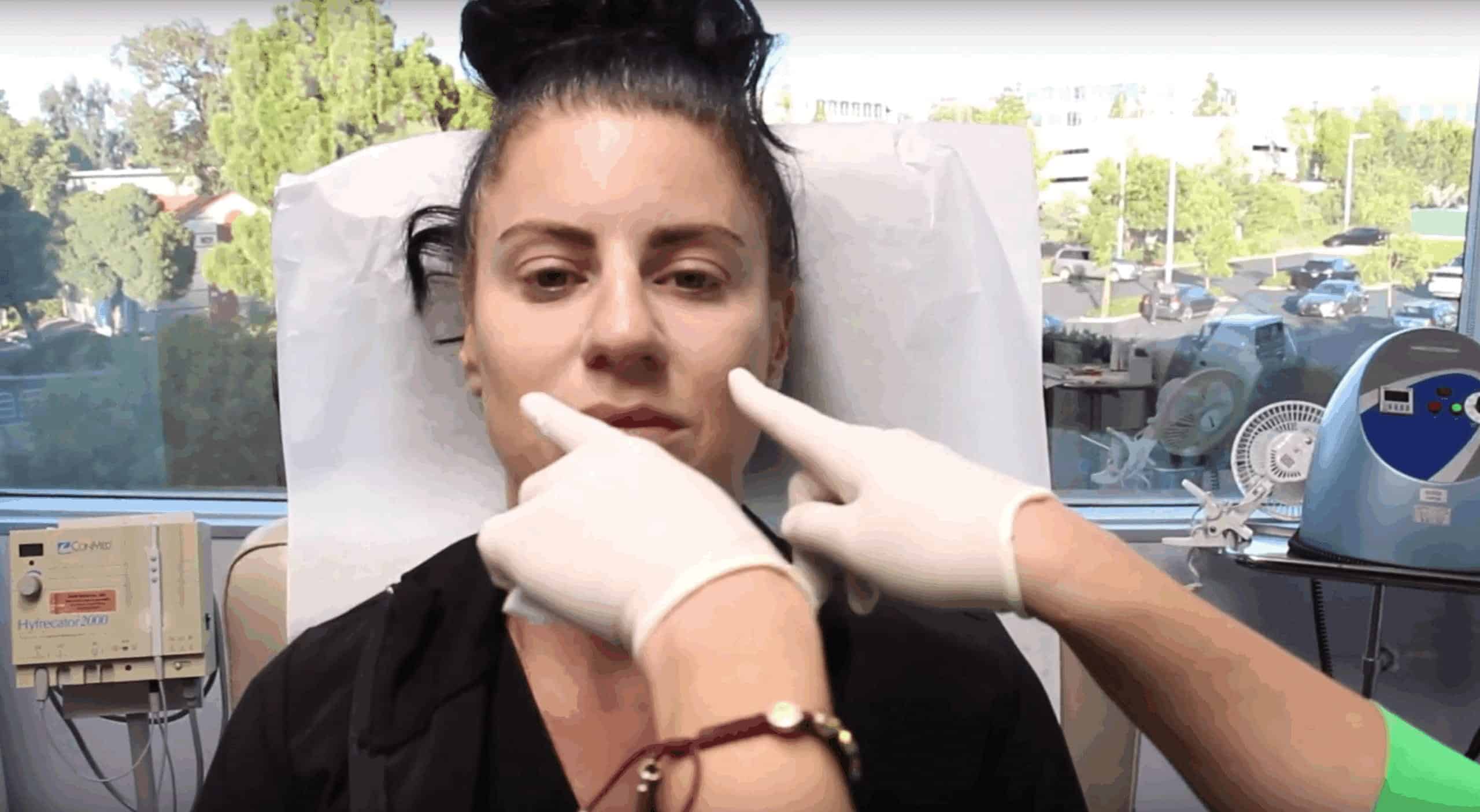 Banner for Dysport to Slim the Lower Face