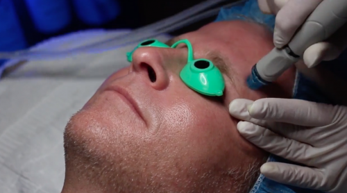 patient getting a skin care procedure