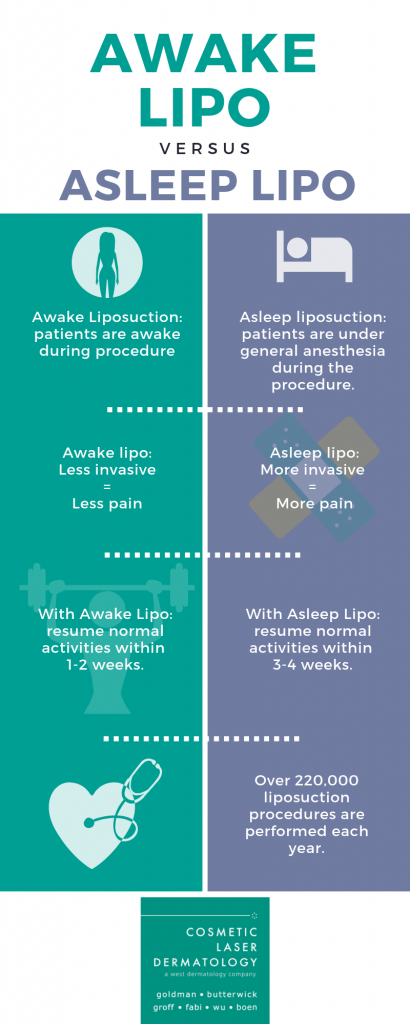 Full Infographic for CLDerm's San Diego awake liposuction blog