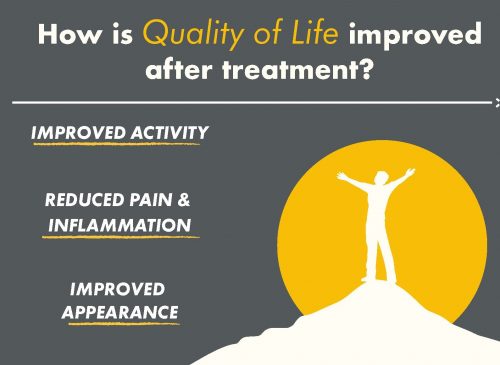 Quality of Life after a sclerotherapy treatment infographic for Cosmetic Laser Dermatology in San Diego.