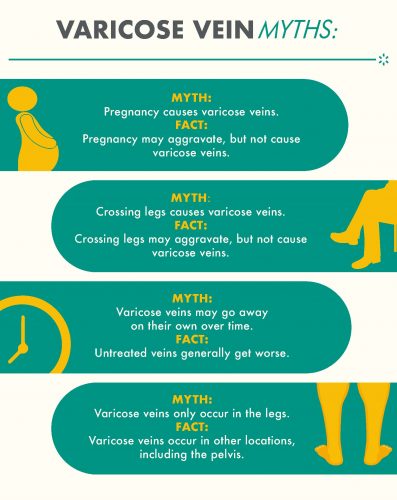 Varicose veins myths vs facts infographic by CLDerm in San Diego