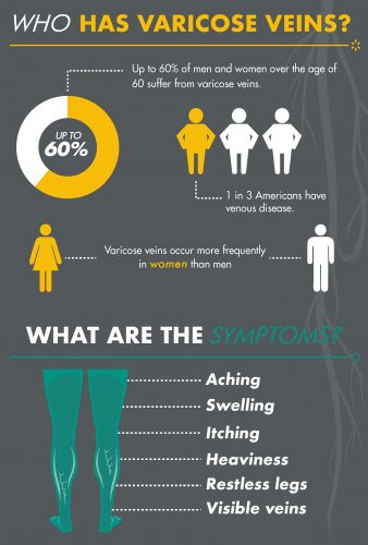 Who has varicose veins infographic for Cosmetic Laser Dermatology in San Diego