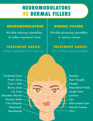 Neuromodulators vs dermal fillers infographic: Treatment areas include forehead lines, frown lines, crow's feet, bunny lines, lip lines, temples, tear troughs, cheeks, nasolabial folds, laugh lines.