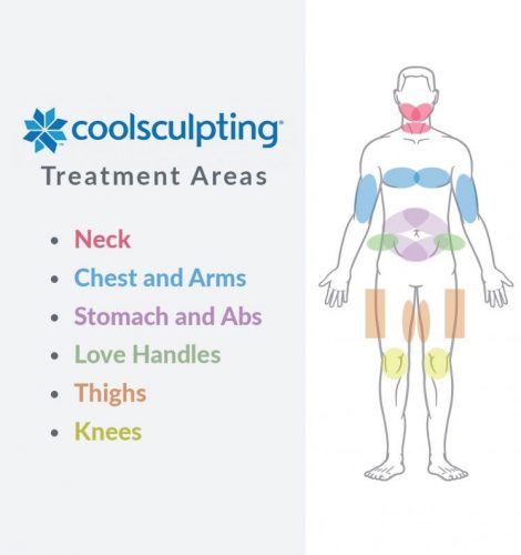 Stomach, Love Handles, Waist & Hips - Coolsculpting Of San Diego