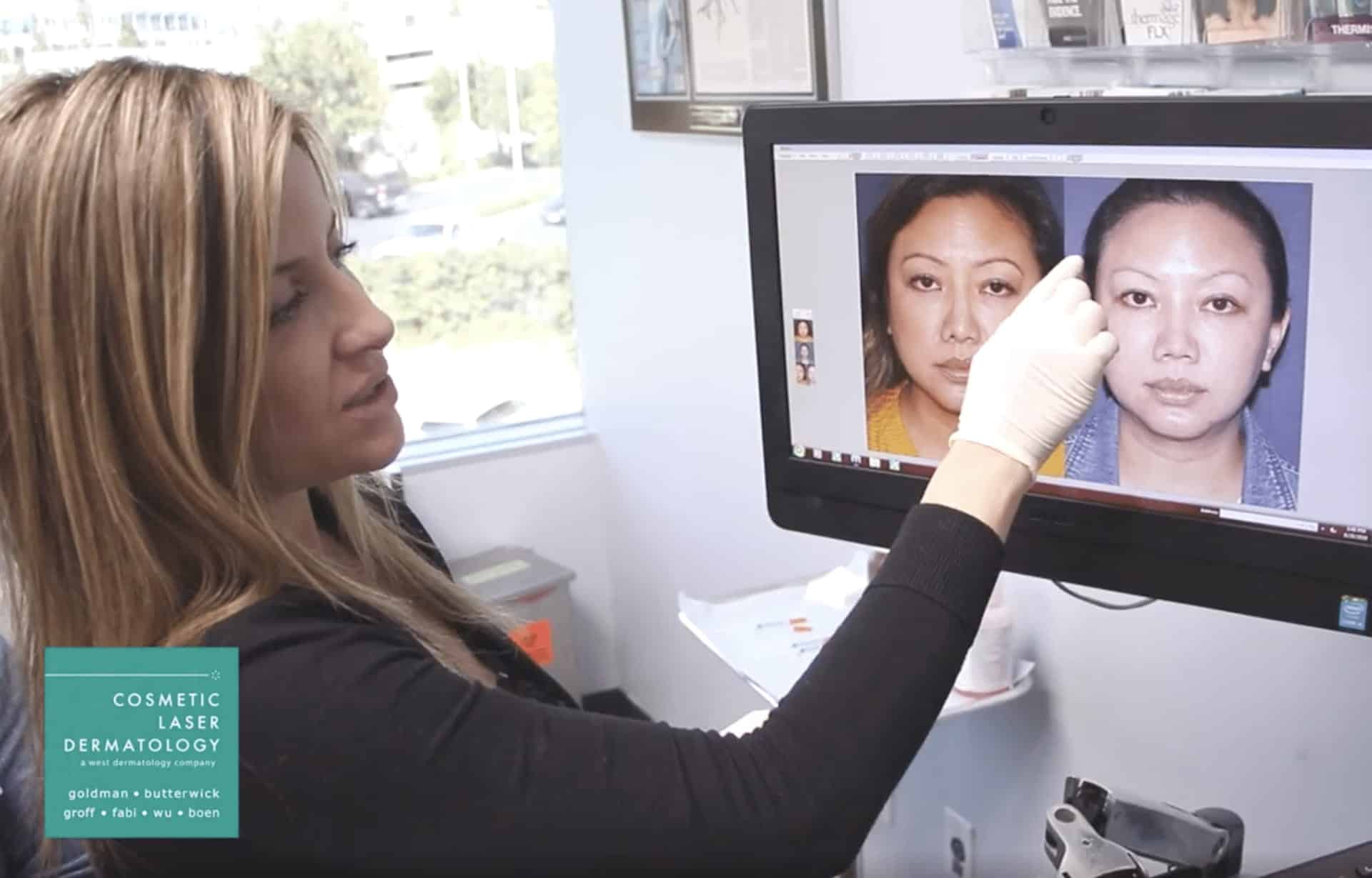 Banner for Botox Injections to Enhance Female Cheek Prominence | Demonstrated by Dr. Sabrina Fabi