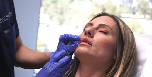 injecting juvederm on the lips