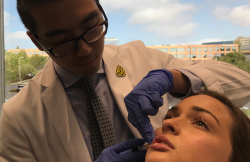 Dr. Wu injecting lip fillers into a patient in San Diego, CA