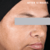 SkinCeuticals Discoloration Defense - Image 5