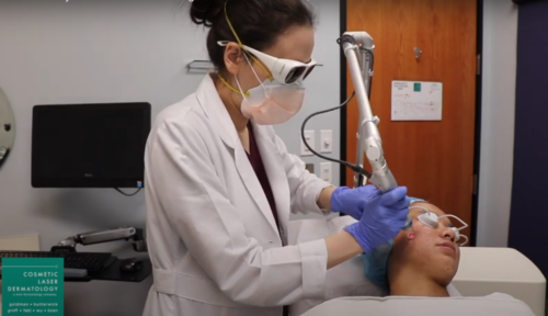 Dramatically Reduce Acne Scarring With This 20-Minute, Non-Invasive Treatment!