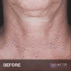Alastin Restorative Neck Complex - Image 2