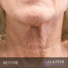 Alastin Restorative Neck Complex - Image 3