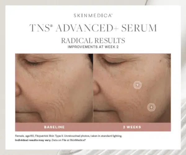 SkinMedica TNS Advanced+ Serum - Image 4