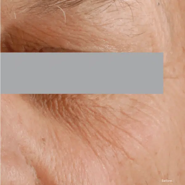 SkinCeuticals A.G.E. Advanced Eye Cream For Dark Circles - Image 2