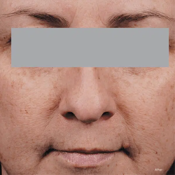 SkinCeuticals Phloretin CF - Image 3