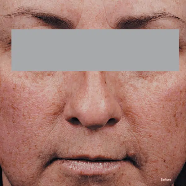 SkinCeuticals Phloretin CF - Image 2