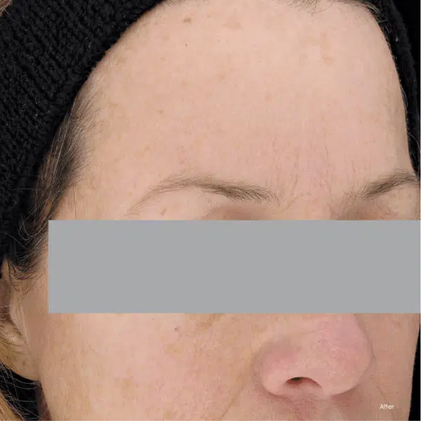 SkinCeuticals Phloretin CF Gel - Image 4