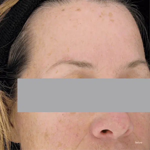 SkinCeuticals Phloretin CF Gel - Image 5