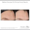 SkinMedica Retinol Complex - Image 5