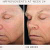 SkinMedica TNS Advanced+ Serum - Image 6