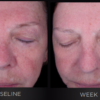 ISDIN Melatonik 3-in-1 Nighttime Serum - Image 8