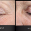 ISDIN Melatonik 3-in-1 Nighttime Serum - Image 7