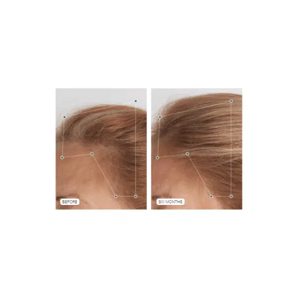 Nutrafol Hair Growth Supplement Women's Balance (ages 40+) - Image 4