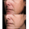 SENTÉ Cysteamine HSA Pigment & Tone Corrector - Image 2