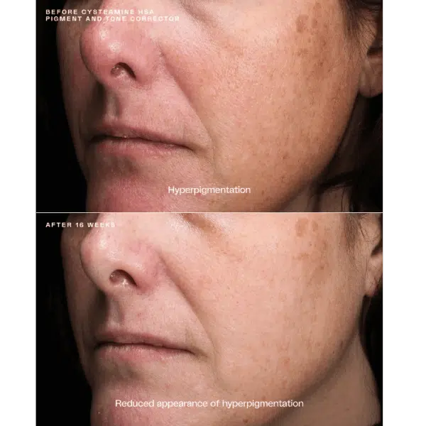 SENTÉ Cysteamine HSA Pigment & Tone Corrector - Image 2