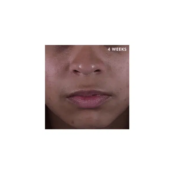 SkinCeuticals Silymarin CF - Image 5