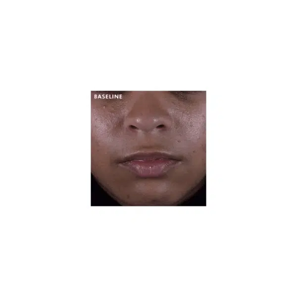 SkinCeuticals Silymarin CF - Image 4