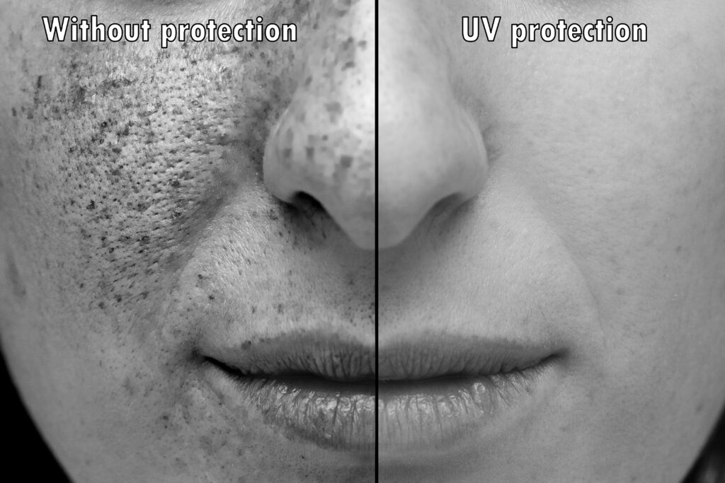 Image comparing sun damaged skin and skin with UV protection