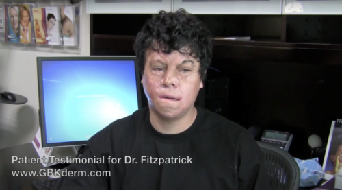 Patient giving a testimonial to Dr. Fitzpatrick of Cosmetic Laser Dermatology in San Diego, CA.